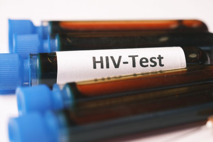 Ein neuer Fall von HIV-Heilung wurde am Montag in der Zeitschrift Nature Medicine vorgestellt. "Düsseldorf-Patient" hat keine Spuren des Virus mehr in seinem Körper / Foto HIV Test pexels © Towfiqu Barbhuiya